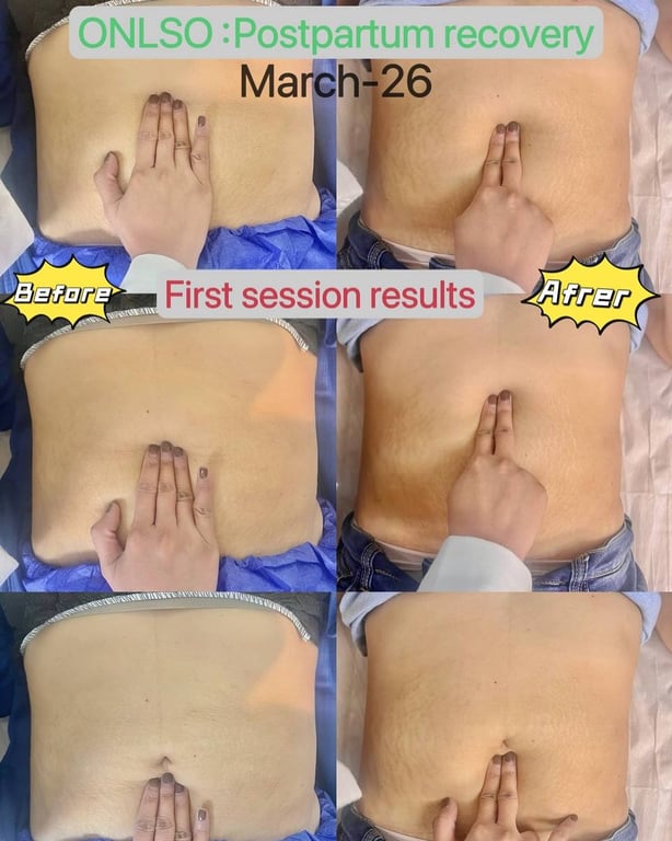 Top 10 Postpartum Recovery Centers in the Philippines 2026 (Research & Field Test Edition | A Must-Read for Expectant Mothers)